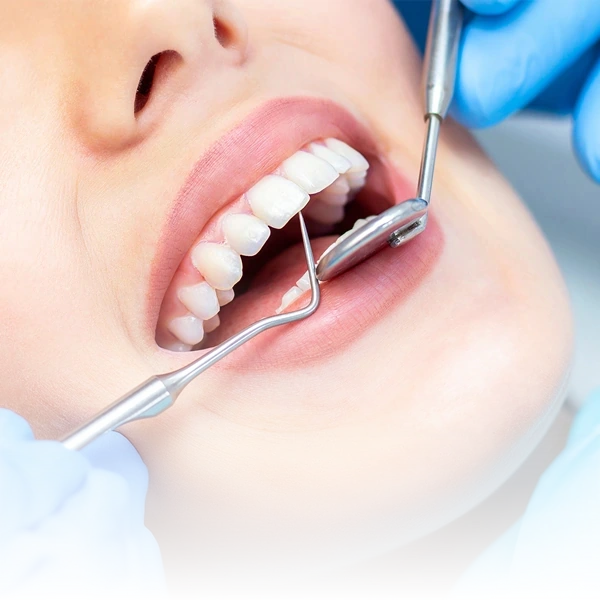 Paciente durante exame dental com espelho e explorador odontológico, utilizado para avaliar a saúde bucal e identificar possíveis problemas, na Clínica IPPO.