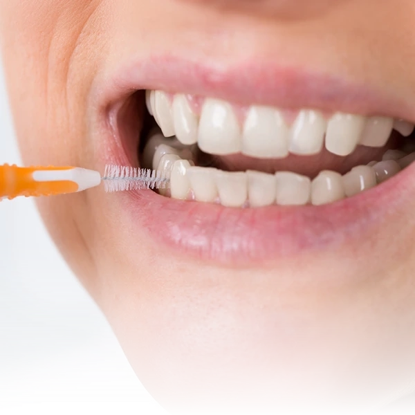 Paciente usando escova interdental para limpeza entre os dentes, promovendo uma higiene bucal completa e prevenção de doenças gengivais.