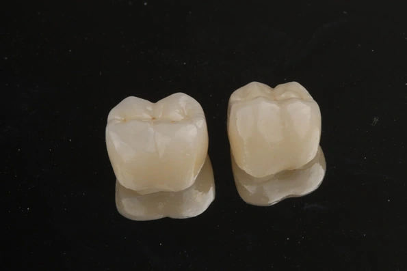 Duas coroas dentárias sobre superfície escura, prontas para serem aplicadas em procedimento de reabilitação dental.