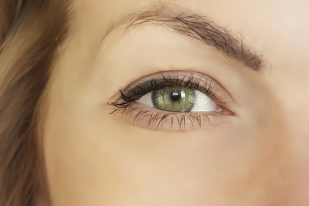 Tratamento com toxina botulínica para atenuar rugas e linhas finas, especialmente em regiões de alta atividade muscular, resultando em uma aparência rejuvenescida.