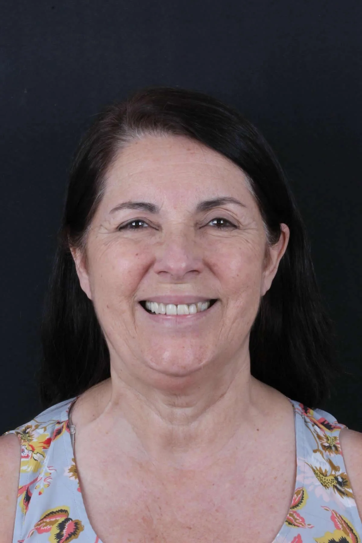 Foto antes do tratamento