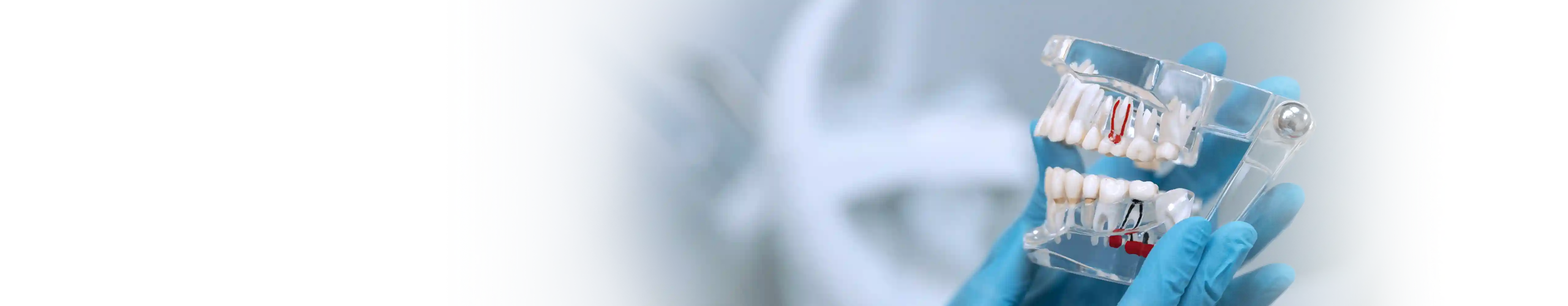 Imagem ilustrativa de próteses dentárias removíveis e fixas, destacando conforto e estética na reposição dental.