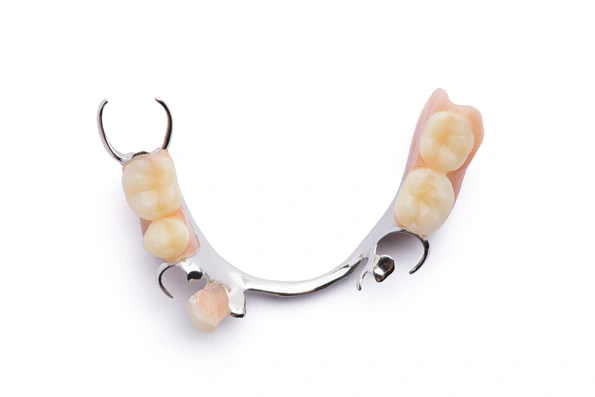 Prótese parcial removível para reposição de dentes ausentes em pacientes com perda dentária parcial.